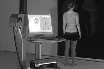 4 D - Posture and Spinal Column Measurement