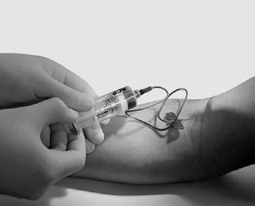 ACP therapy Berlin-Frohnau