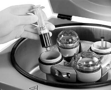 acp therapy
