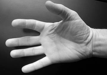 Hand surgery in Berlin-Frihnau